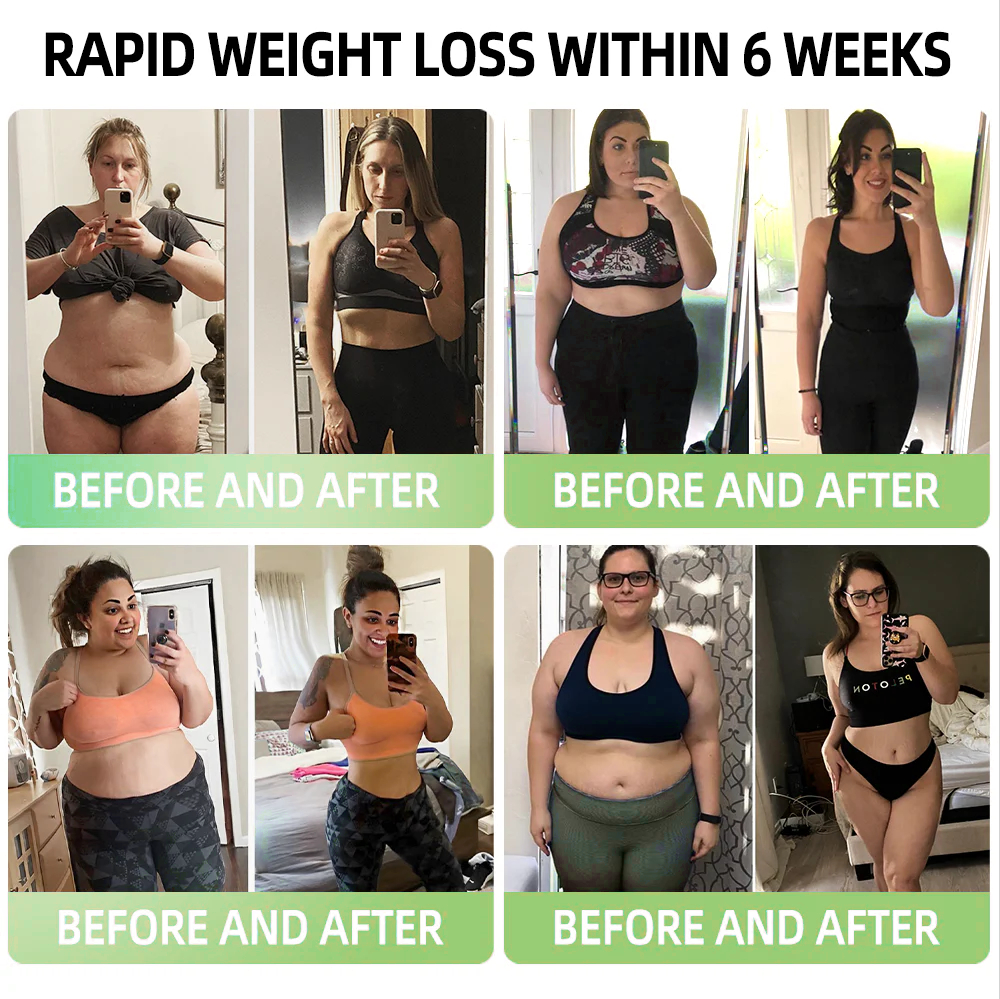【Only 8 left!】 🛒 Get an extra 30% off now! 🎉Tested by weight loss experts, alternating 4-6 pairs will help you achieve your ideal shape. 🎁Don’t miss out—this offer won’t be back for another year! Grab this limited-time deal now! 🎉